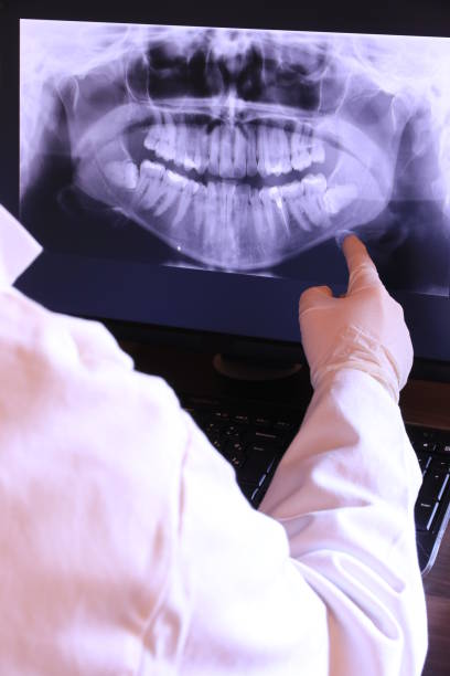 Best Emergency Dental Care for Broken or Chipped Teeth in Wild Peach Village, TX