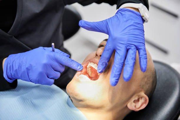 Best Emergency Dental Care for Broken or Chipped Teeth in Wild Peach Village, TX